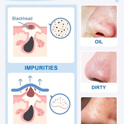 SlowSunday Blackhead Remover Nose Strips