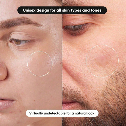 360pcs Hydrocolloid Round Acne Patches - SmartSouks