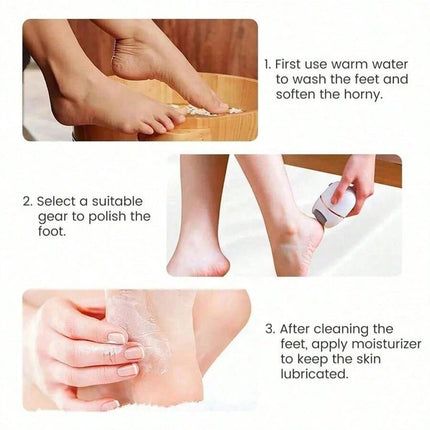 Electric Foot Callus Remover White - SmartSouks