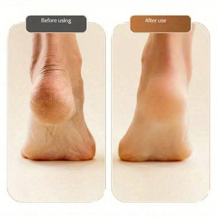 Electric Foot Callus Remover White - SmartSouks