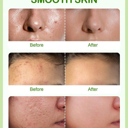 SlowSunday Anti-Blemish Tea Tree Serum 15ml - SmartSouks