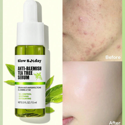 SlowSunday Anti-Blemish Tea Tree Serum 15ml - SmartSouks